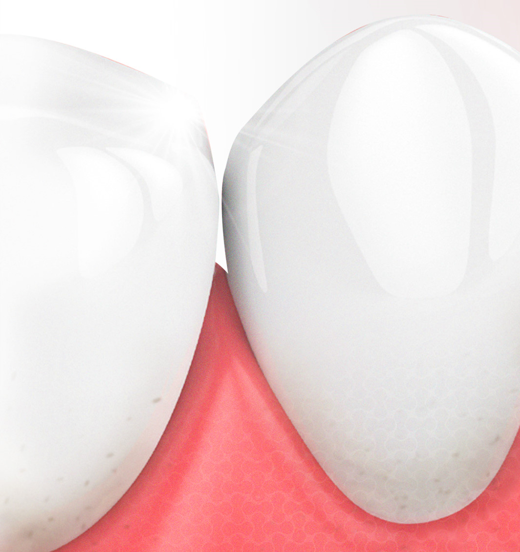 clean teeth